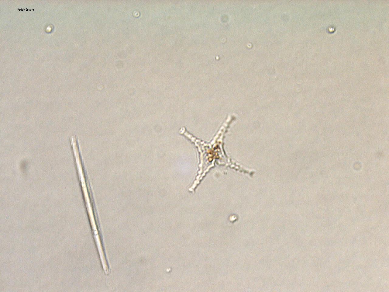 Staurastrum